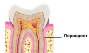 Периодонтит зуба – причины, симптомы и лечение Периодонтит зуба причины