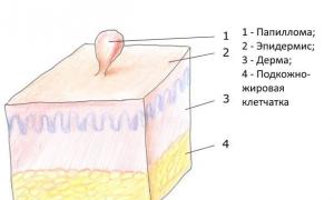 Лечение папиллом народными самыми эффективными средствами